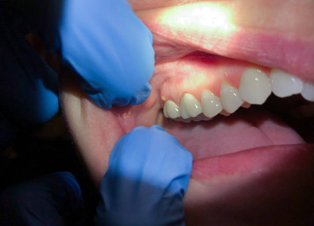 Best Cracked Tooth Emergency Dentist  in Red Lion, PA