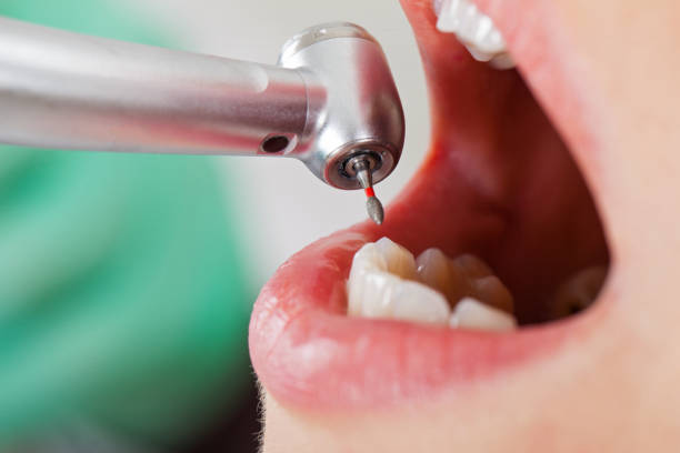 Best Knocked-Out Tooth Emergency  in Red Lion, PA